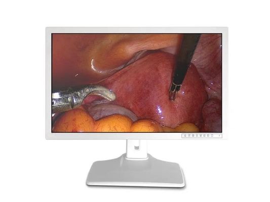 Tıbbi Endoskop Monitör Ekranı 32 inç 3840 X 2160