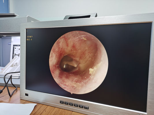 Full HD 1080P 4'ü 1 arada Tek Entegre Taşınabilir Tıbbi Endoskop Kamera Sistemi