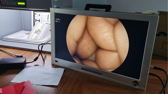 Full HD 1080P 4'ü 1 arada Tek Entegre Taşınabilir Tıbbi Endoskop Kamera Sistemi