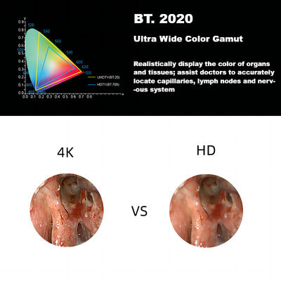 DEC 3840A Laparoskopi için Yeni 4K Ultra HD Tıbbi Endoskop Kamera Sistemi